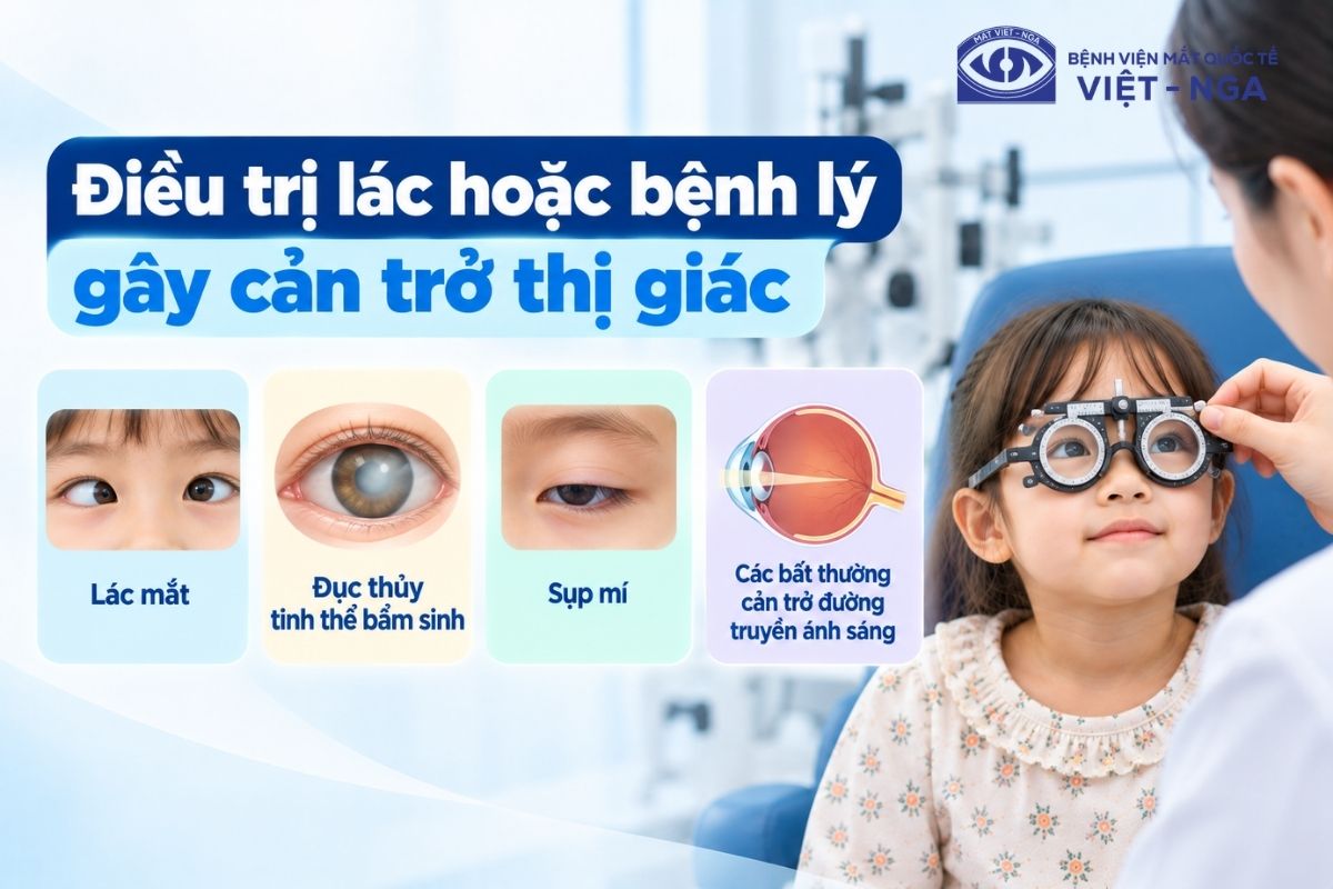 Phẫu thuật chỉnh lác hoặc xử lý đục thủy tinh thể bẩm sinh nhằm tái lập đường truyền ánh sáng vào võng mạc.