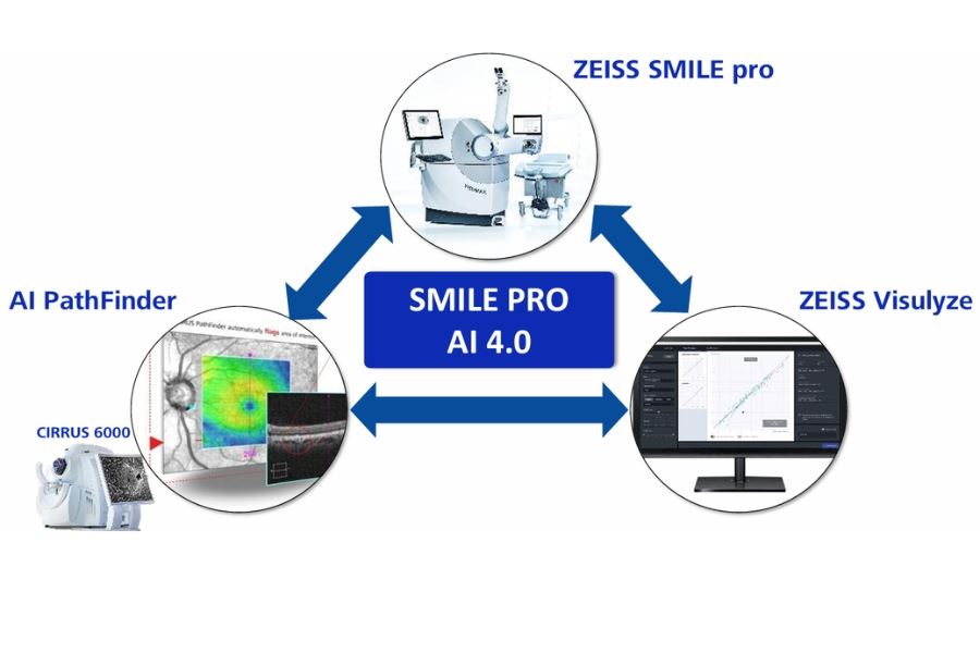 Xóa cận cá nhân hóa với SMILE Pro AI 4.0, nâng cao độ chính xác trong điều trị tật khúc xạ
