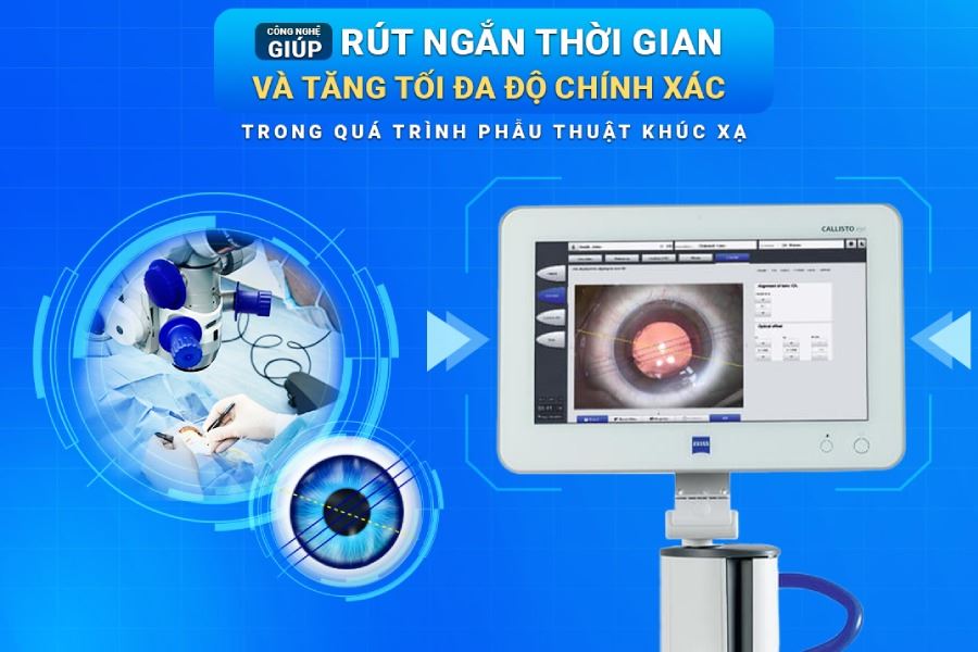 2 công nghệ tiên tiến bổ trợ trong phẫu thuật nhãn khoa tại Mắt Việt – Nga