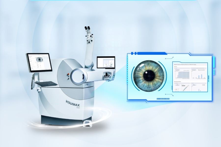 Top các phương pháp xóa cận nhanh, hồi phục sau 24h tại Mắt Việt – Nga