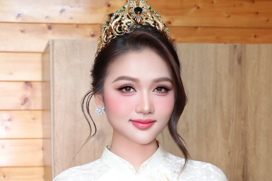 Á hậu Thu Ngân xóa cận Smile Pro AI 4.0: Mổ mắt xong make up, catwalk đều tự tin