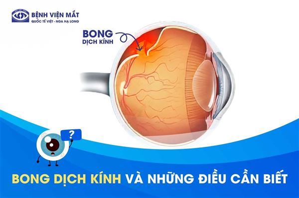 Bong dịch kính có nguy hiểm không?