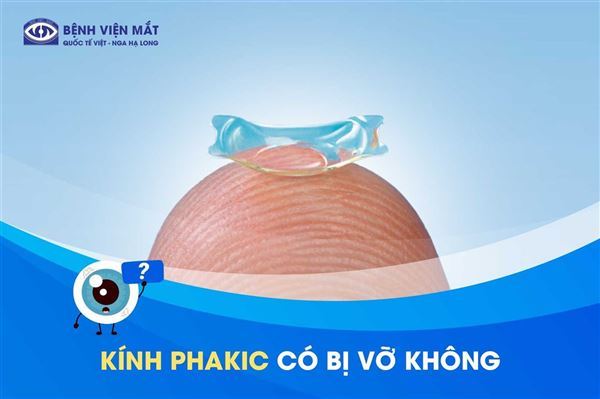 Giải đáp: Kính Phakic ICL có dễ vỡ nếu tác động mạnh?