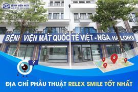 Top địa chỉ phẫu thuật Relex Smile tốt nhất hiện nay