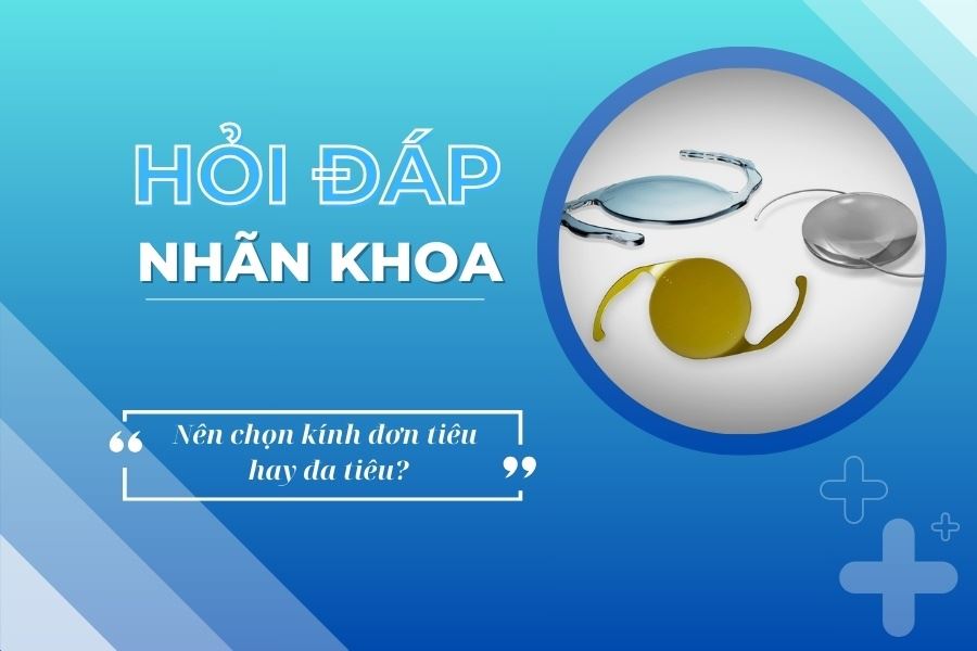 Hỏi đáp nhãn khoa: Phẫu thuật thay thủy tinh thể nên chọn kính đơn tiêu hay đa tiêu?