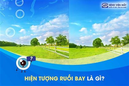 Ruồi bay trước mắt là bệnh lý gì? Diệt ruồi thế nào hiệu quả?