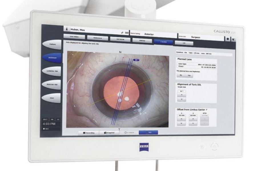 Video: Vì sao nên chọn công nghệ Callisto Eye trong phẫu thuật đục thủy tinh thể?