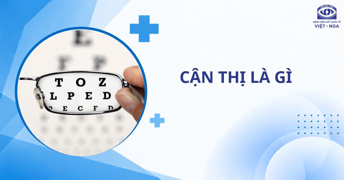 Cận thị là gì? Mức độ, dấu hiệu và phương pháp điều trị