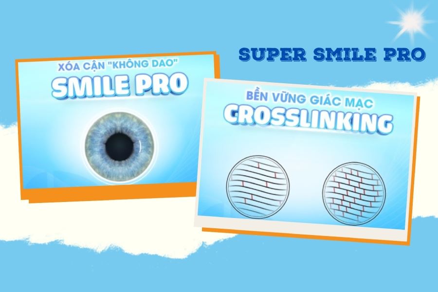 Những yếu tố khiến Super Smile Pro trở thành công nghệ xóa cận dẫn đầu tại Mắt Việt – Nga