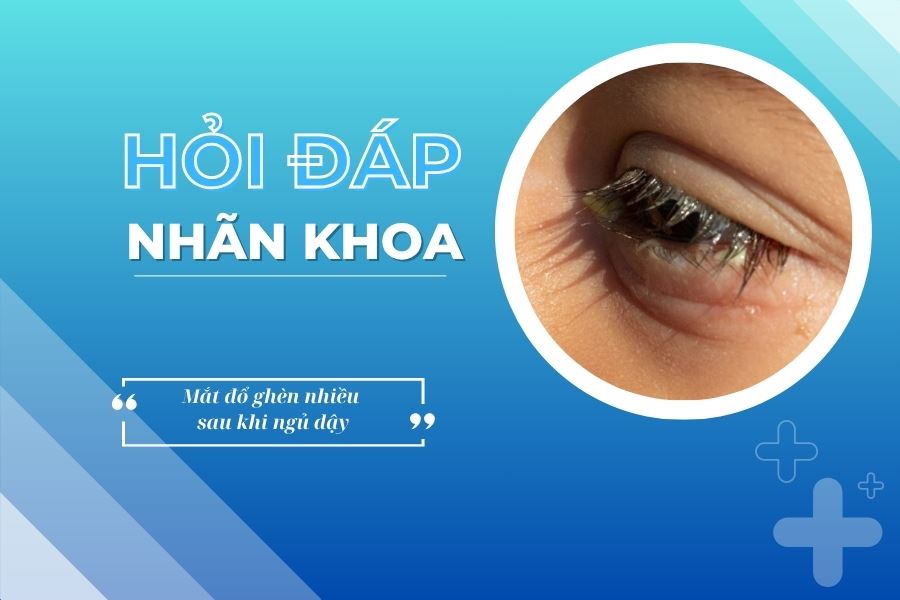 Hỏi đáp nhãn khoa: Vì sao mắt bị đổ ghèn nhiều sau khi ngủ dậy?