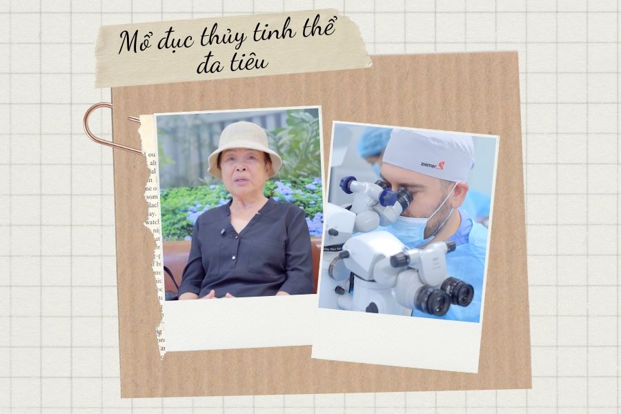 [Review] U80 lựa chọn thủy tinh thể đa tiêu vì muốn tốt nhất cho đôi mắt