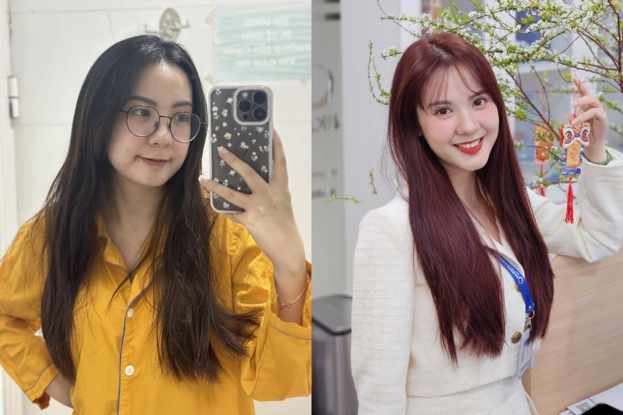 Cận loạn kèm khô mắt, 9X văn phòng chia sẻ bí quyết xóa cận an toàn, nhanh hồi phục