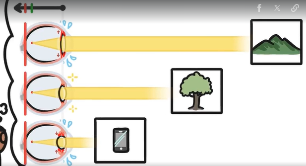 Video: Vì sao trẻ em dễ bị cận thị?