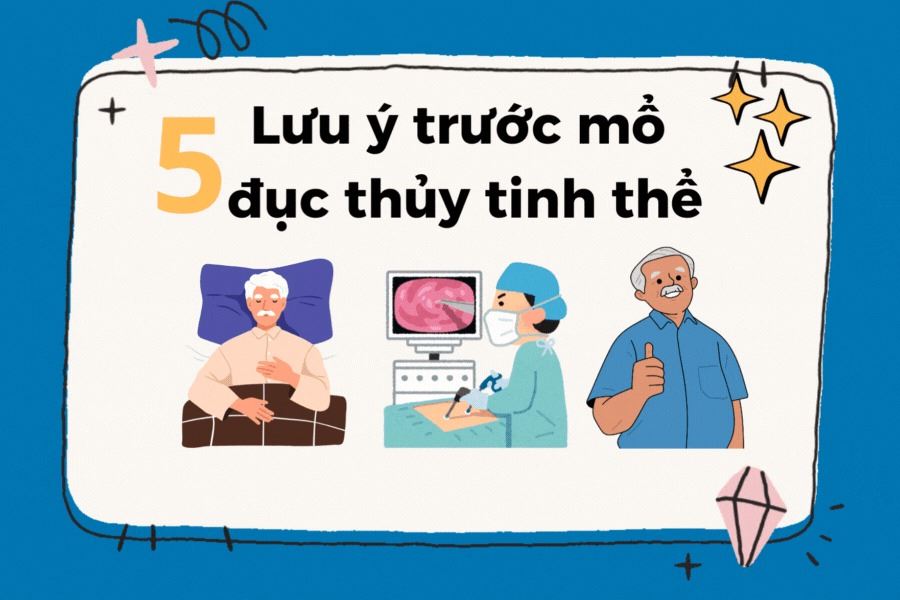 Infographic: 5 Lưu ý trước mổ đục thủy tinh thể bệnh nhân cần ghi nhớ